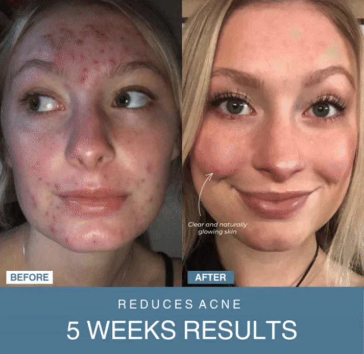 7-in-1 LED Anti-Aging/Wrinkle Apparatus